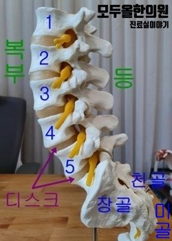 허리디스크(요추추간판탈출증), 찌릿찌릿한 느낌 추나요법으로 치료해요.